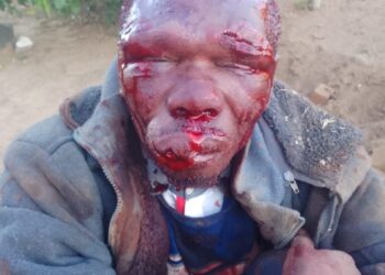 Mob Justice Turns on Alleged Burglar in Meqheleng