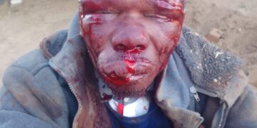 Mob Justice Turns on Alleged Burglar in Meqheleng