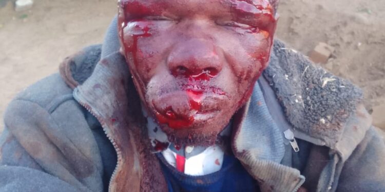 Mob Justice Turns on Alleged Burglar in Meqheleng