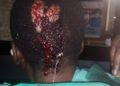Ficksburg Resident Sought by Police for Brutal Assault