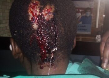 Ficksburg Resident Sought by Police for Brutal Assault