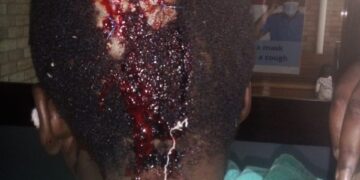 Ficksburg Resident Sought by Police for Brutal Assault